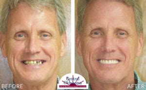 oral and maxillofacial surgery tulsa.